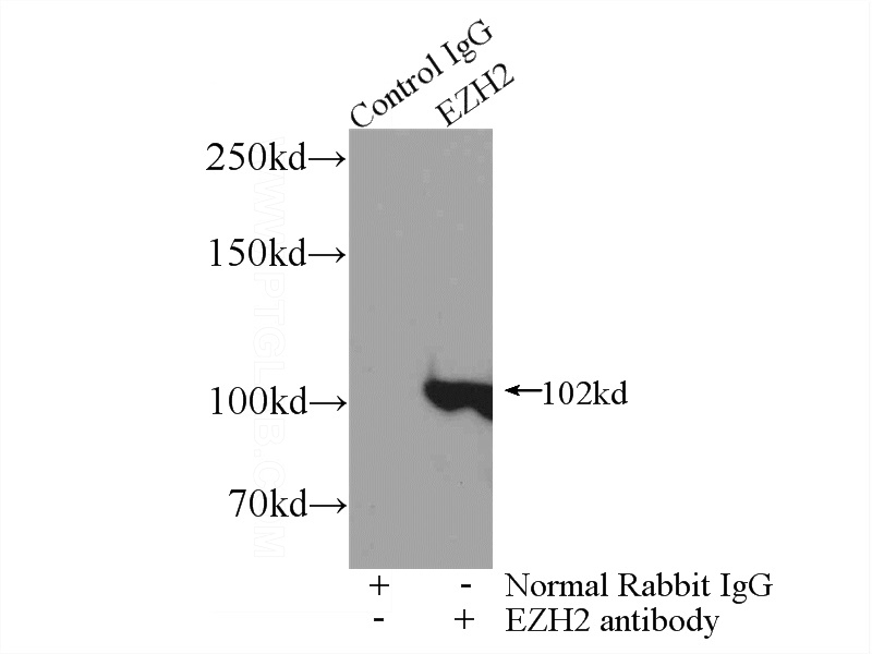IP Result of anti-EZH2 (IP:Catalog No:110425, 4ug; Detection:Catalog No:110425 1:1500) with HepG2 cells lysate 4000ug.