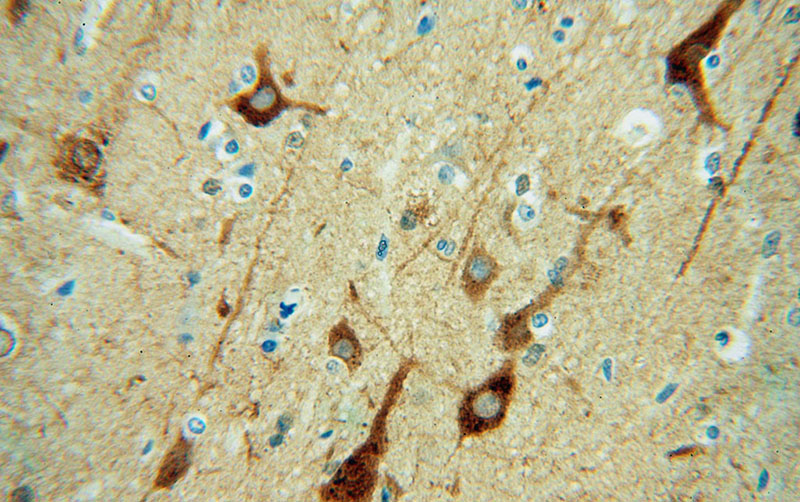 Immunohistochemical of paraffin-embedded human brain using Catalog No:110549(FBXO2 antibody) at dilution of 1:50 (under 40x lens)