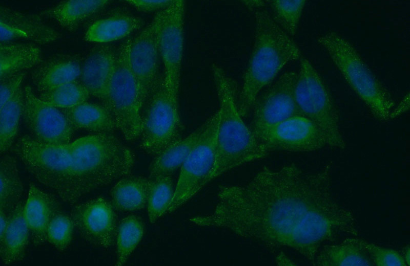 Immunofluorescent analysis of (10% Formaldehyde) fixed HeLa cells using Catalog No:110711(FOXP3 Antibody) at dilution of 1:50 and Alexa Fluor 488-congugated AffiniPure Goat Anti-Rabbit IgG(H+L)