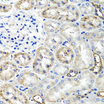 Immunohistochemistry - TNFAIP6 Polyclonal Antibody 