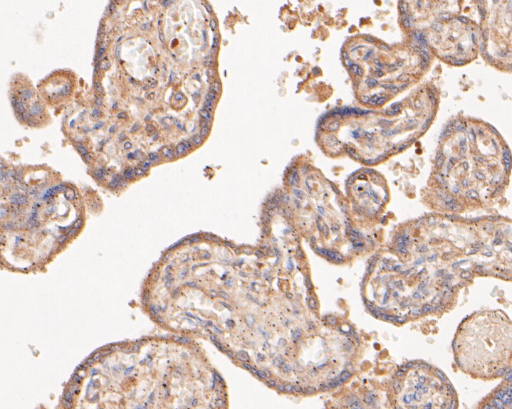 Fig4:; Immunohistochemical analysis of paraffin-embedded human placenta tissue using anti-GADD34 antibody. The section was pre-treated using heat mediated antigen retrieval with Tris-EDTA buffer (pH 8.0-8.4) for 20 minutes.The tissues were blocked in 5% BSA for 30 minutes at room temperature, washed with ddH; 2; O and PBS, and then probed with the primary antibody ( 1/200) for 30 minutes at room temperature. The detection was performed using an HRP conjugated compact polymer system. DAB was used as the chromogen. Tissues were counterstained with hematoxylin and mounted with DPX.
