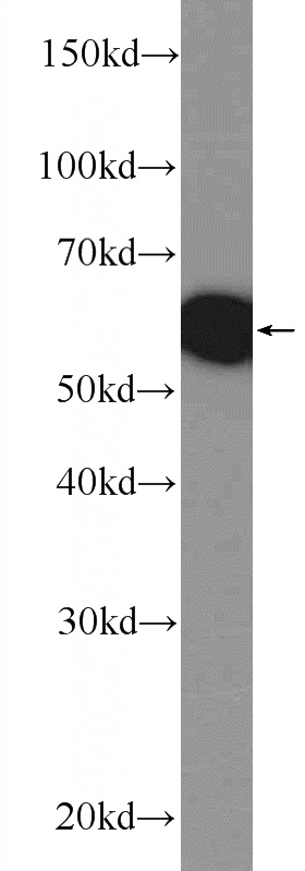 mouse brain tissue were subjected to SDS PAGE followed by western blot with Catalog No:109266(CEP152 Antibody) at dilution of 1:300