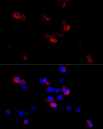 Immunofluorescence - FLNB Polyclonal Antibody 