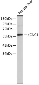 Western blot - KCNC1 Polyclonal Antibody 