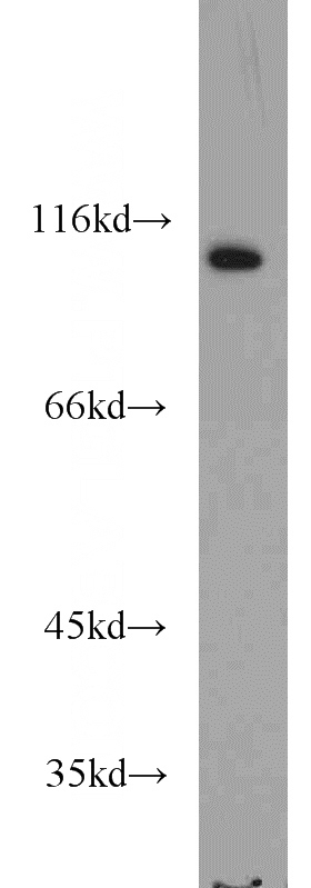 A549 cells were subjected to SDS PAGE followed by western blot with Catalog No:116689(USP5 antibody) at dilution of 1:1000