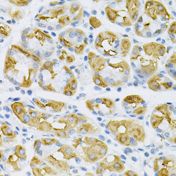 Immunohistochemistry - SDC4 Polyclonal Antibody 
