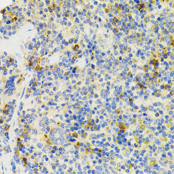 Immunohistochemistry - SH2B1 Polyclonal Antibody 