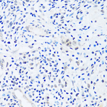 Immunohistochemistry - BRIX1 Polyclonal Antibody 