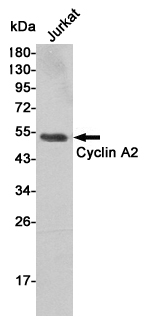 Western blot detection of Cyclin A2 in Jurkat cell lysates using Cyclin A2 mouse mAb (1:1000 diluted).Predicted band size:50KDa.Observed band size:50KDa.