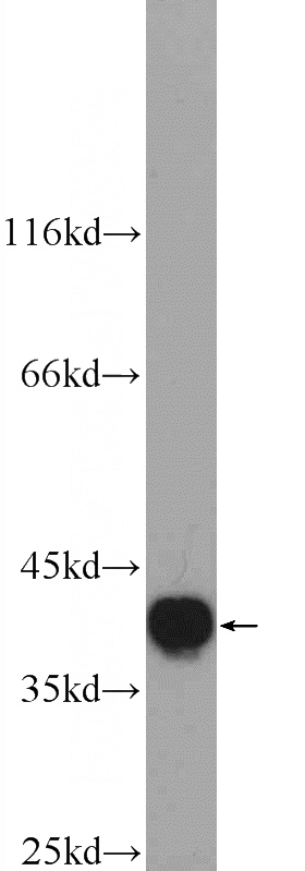 mouse liver tissue were subjected to SDS PAGE followed by western blot with Catalog No:111502(HNRNPA3 Antibody) at dilution of 1:1000