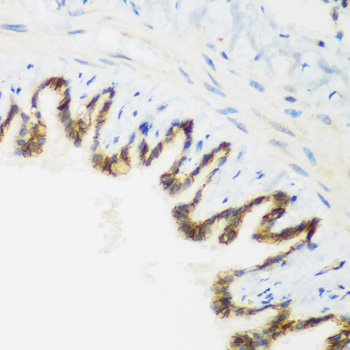 Immunohistochemistry - KIAA1456 Polyclonal Antibody 