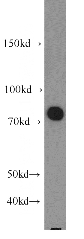 human brain tissue were subjected to SDS PAGE followed by western blot with Catalog No:110500(EXoc7 antibody) at dilution of 1:500