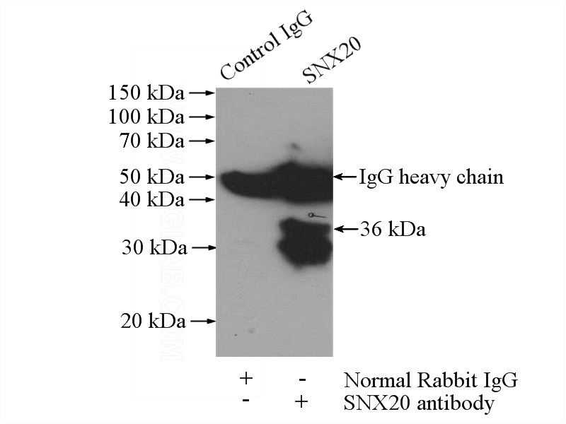 IP Result of anti-SNX20 (IP:Catalog No:115475, 4ug; Detection:Catalog No:115475 1:300) with COLO 320 cells lysate 2000ug.