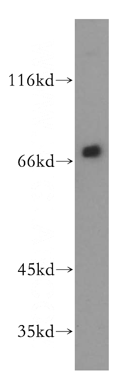 HepG2 cells were subjected to SDS PAGE followed by western blot with Catalog No:114207(PRMT5 antibody) at dilution of 1:800