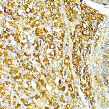 Immunohistochemistry - VAMP1 Polyclonal Antibody 