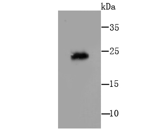 Fig1: Western blot analysis of IL7 on human thymus cell lysates using anti- IL7 antibody at 1/500 dilution.