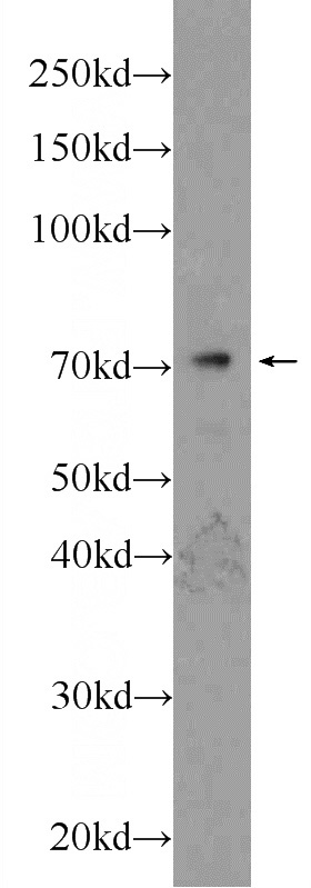 mouse lung tissue were subjected to SDS PAGE followed by western blot with Catalog No:115905(TCF4 Antibody) at dilution of 1:600