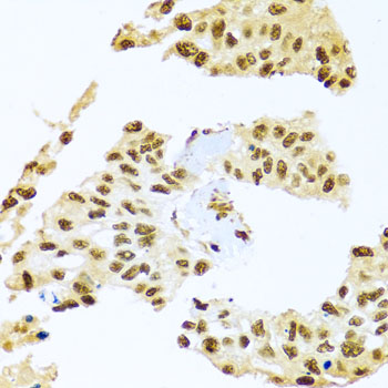 Immunohistochemistry - SMEK1 Polyclonal Antibody 