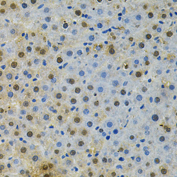 Immunohistochemistry - BUB1 Polyclonal Antibody 