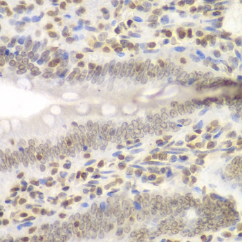 Immunohistochemistry - UHRF2 Polyclonal Antibody 