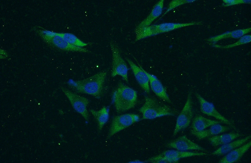 Immunofluorescent analysis of A375 cells using Catalog No:116810(VWA2 Antibody) at dilution of 1:50 and Alexa Fluor 488-congugated AffiniPure Goat Anti-Rabbit IgG(H+L)