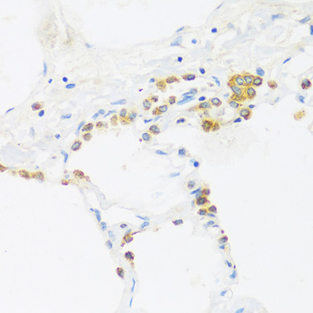 Immunohistochemistry - C1GALT1 Polyclonal Antibody 