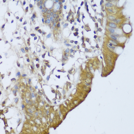 Immunohistochemistry - GCN1L1 Polyclonal Antibody 