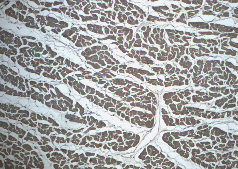 Immunohistochemistry of paraffin-embedded human heart slide using Catalog No:112633(MEF2C Antibody) at dilution of 1:50