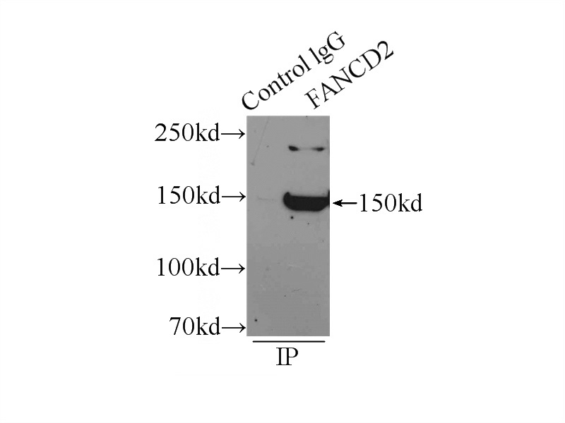 IP Result of anti-FANCD2 (IP:Catalog No:110517, 4ug; Detection:Catalog No:110517 1:300) with mouse testis tissue lysate 6000ug.