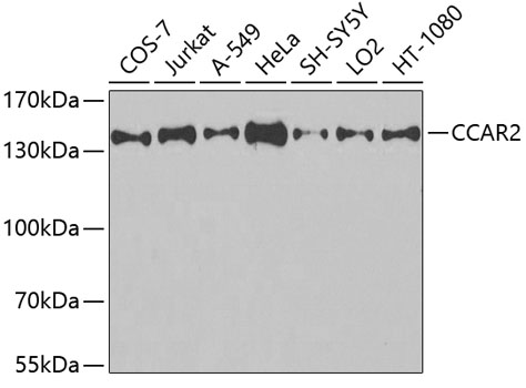 Western blot - CCAR2 Monoclonal Antibody 