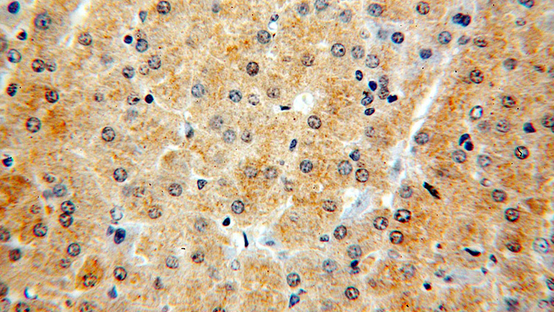 Immunohistochemical of paraffin-embedded human liver using Catalog No:114412(RAB12 antibody) at dilution of 1:100 (under 40x lens)