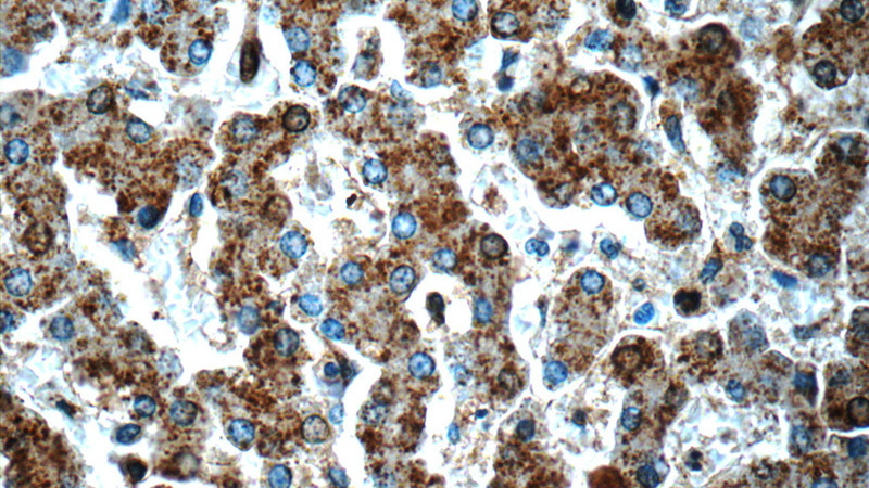 Immunohistochemistry of paraffin-embedded human liver slide using Catalog No:111058(GPATCH4 Antibody) at dilution of 1:50