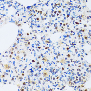 Immunohistochemistry - MTA3 Polyclonal Antibody 
