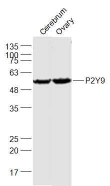 Fig5: Sample:; Cerebrum (Mouse) Lysate at 40 ug; Ovary (Mouse) Lysate at 40 ug; Primary: Anti-P2Y9 at 1/1000 dilution; Secondary: IRDye800CW Goat Anti-Rabbit IgG at 1/20000 dilution; Predicted band size: 42 kD; Observed band size: 57 kD
