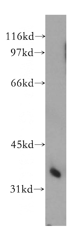 human liver tissue were subjected to SDS PAGE followed by western blot with Catalog No:114095(PPP2CA antibody) at dilution of 1:300