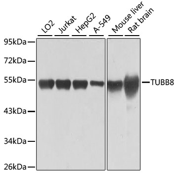 Western blot - TUBB8 Polyclonal Antibody 
