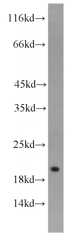 mouse brain tissue were subjected to SDS PAGE followed by western blot with Catalog No:113355(NUDT11 antibody) at dilution of 1:800