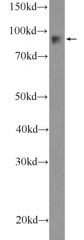 HeLa cells were subjected to SDS PAGE followed by western blot with Catalog No:110794(FURIN Antibody) at dilution of 1:600