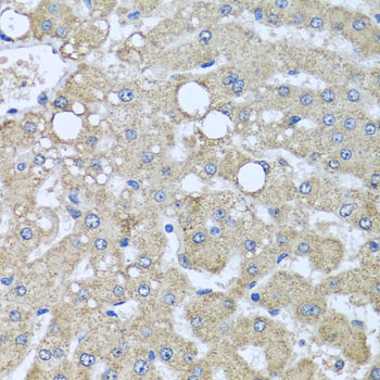 Immunohistochemistry - DCP2 Polyclonal Antibody 