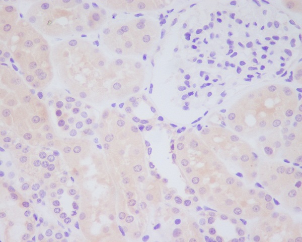 Immunohistochemical analysis of paraffin-embedded human kdieny, using MMP14 Antibody .