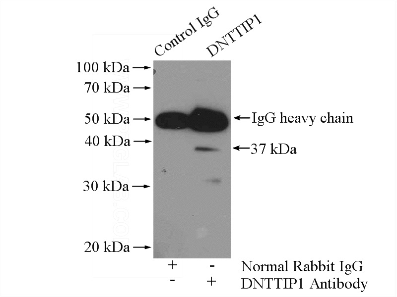 IP Result of anti-DNTTIP1 (IP:Catalog No:109973, 4ug; Detection:Catalog No:109973 1:300) with HeLa cells lysate 1200ug.