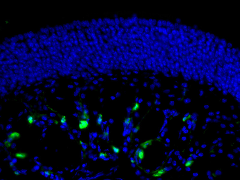 Fluorescent IHC on 1%PLP fixed frozen mouse olfactory epithelium tissue of FST antibody (Catalog No:110742, 1:100). Interesting lamina propria cell stained below the olfactory epithelium. By Dr. Brian Lin (Schwob Lab).
