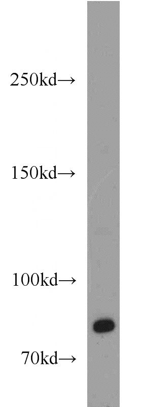 HeLa cells were subjected to SDS PAGE followed by western blot with Catalog No:115942(CD248 antibody) at dilution of 1:500