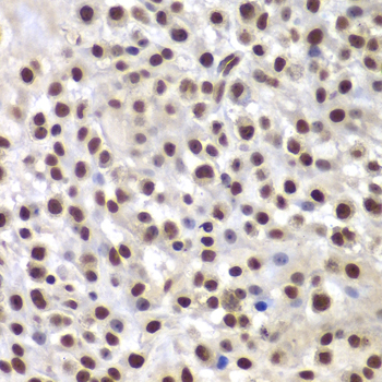 Immunohistochemistry - SMARCB1 Polyclonal Antibody 