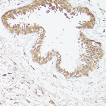 Immunohistochemistry - GRM4 Polyclonal Antibody 