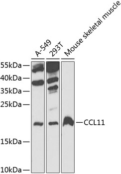 Western blot - CCL11 Polyclonal Antibody 