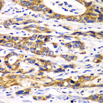 Immunohistochemistry - RPN1 Polyclonal Antibody 
