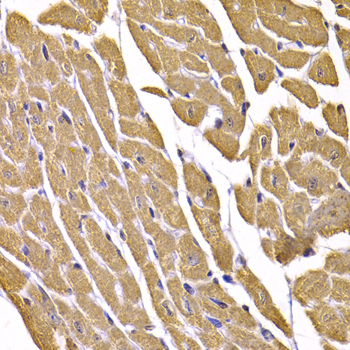 Immunohistochemistry - GLUT4 Polyclonal Antibody 