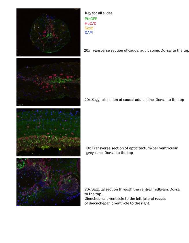 IF result of anti-SOX2(Catalog No:115515) in Zebrafish by Dr. Caroline Parkin.
