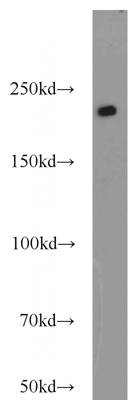 mouse uterus tissue were subjected to SDS PAGE followed by western blot with Catalog No:115391(MYH11 antibody) at dilution of 1:3000